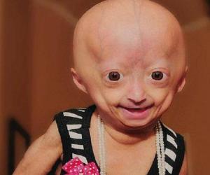 Adalia Rose